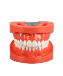 Standard Model with 28 Screw-in Teeth