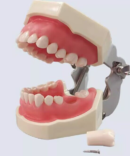Standard Model with 28 Screw-in Teeth